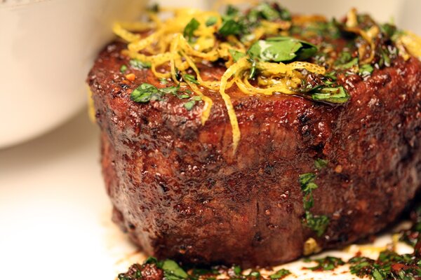 Cholesterol+deposits+on+eye